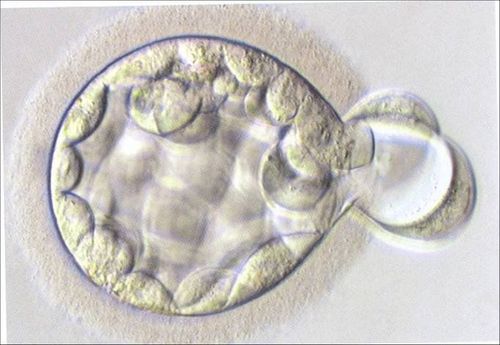 What is embryo culture? Why do it?