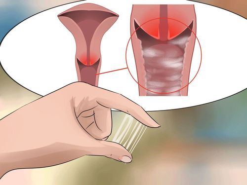 Vaginal infections are the leading cause of blocked fallopian tubes