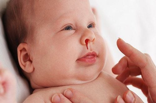 Nên làm gì khi trẻ hơn 1 tuổi chảy máu mũi thường xuyên?