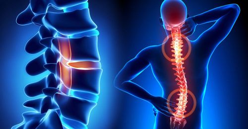 Meaning of magnetic resonance imaging (MRI) of the thoracic spine