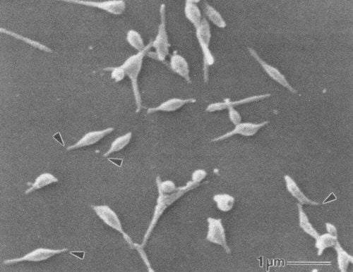 
Hình ảnh vi khuẩn Mycoplasma pneumoniae
