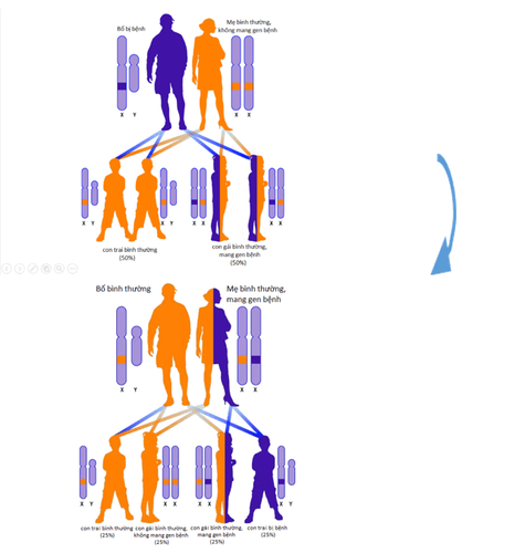 
Cơ chế di truyền gen lặn nằm trên nhiễm sắc thể giới tính X của bệnh thiếu enzyme G6PD.
