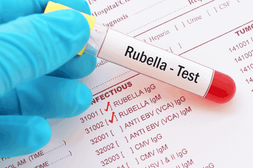 What is a negative Rubella IgM and positive IgG test result?