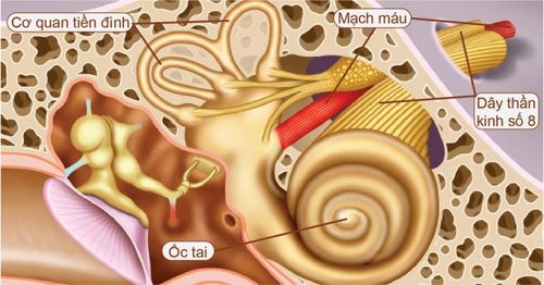 U thần kinh số 8 tái phát điều trị như thế nào?