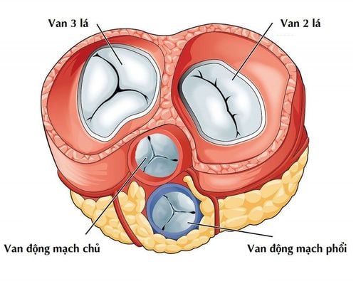 Bệnh hở van hai lá khác gì bệnh hẹp van hai lá?