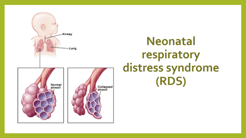 
Hội chứng suy hô hấp (respiratory distress syndrome - RDS)
