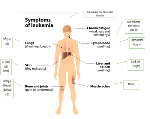 
                    Symptoms of leukemia
                