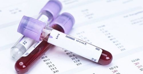 Can blood chemistry test detect HIV?