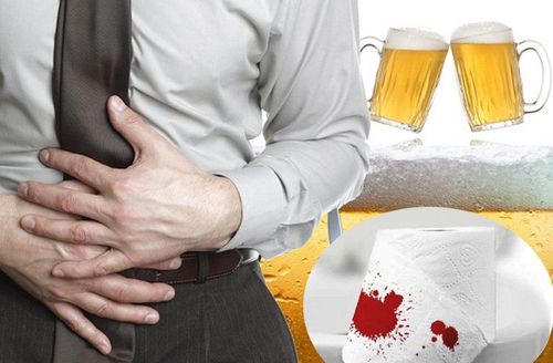 Đi ngoài ra máu tươi kèm nhỏ giọt nhiều sau khi uống rượu bia có sao không?