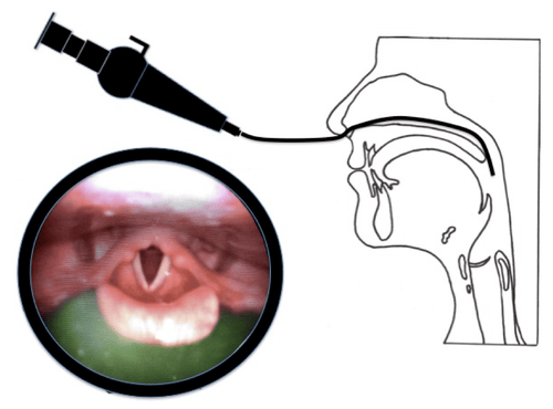 Steps of ENT endoscopy