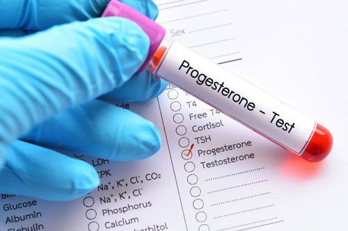 Instructions for reading Progesterone test results