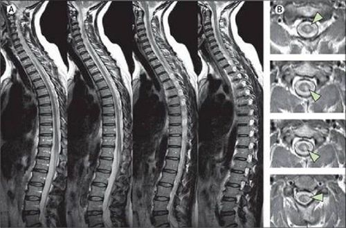 
Hình ảnh MRI cột sống
