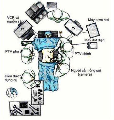 Những điều cần biết về bệnh lý viêm túi mật cấp do sỏi túi mật