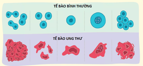 
Tình trạng các tế bào phân chia không kiểm soát là nguyên nhân dẫn đến ung thư.
