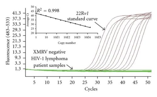 
Xét nghiệm PCR tìm RNA HIV
