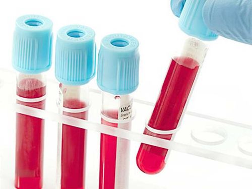 The lactic acid dehydrogenase test measures the concentration of LHD in the blood