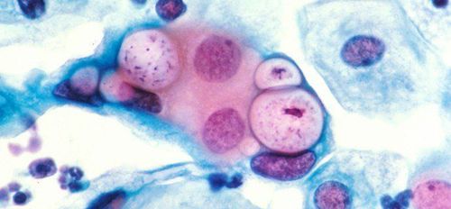 
Hình ảnh Chlamydia Trachomatis
