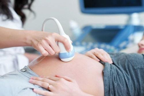 Can pregnant women eat before ultrasound?