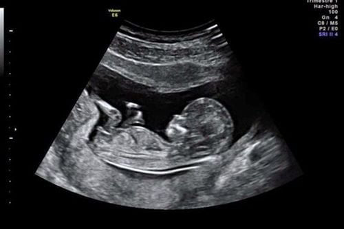 Ultrasound can help detect many important conditions of the mother and fetus.