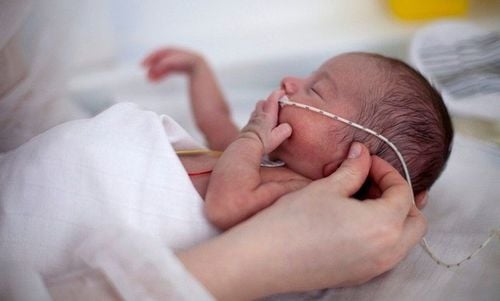 Premature birth and the health risks of premature babies