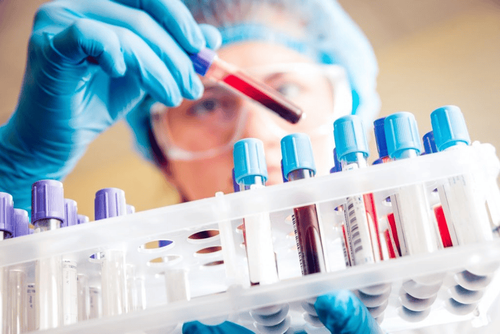 Xét nghiệm máu tổng quát có phát hiện được vi khuẩn HP không?