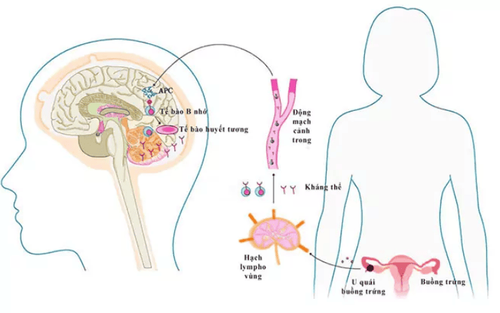 
Bệnh viêm não tự miễn
