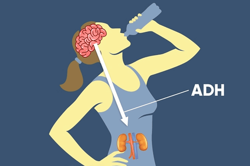 Hypernatremia due to abnormal ADH secretion syndrome