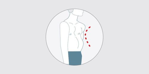 Congenital dimple in the chest in children: Symptoms and complications