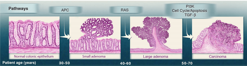 The role of genetic testing in breast and ovarian cancer risk assessment