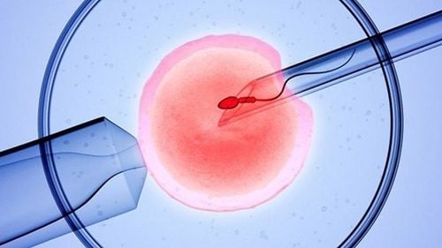 Nguyên nhân nào khiến IVF thất bại?