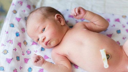 Understanding umbilical cystic disease in infants