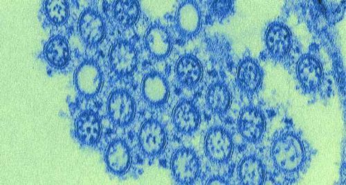Virus cúm A: Những điều cần biết