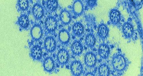 
Virus cúm A (H1N1) có nguồn gốc từ virus cúm xuất hiện ở đại dịch năm 2009
