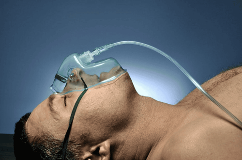 What you need to know about general anesthesia