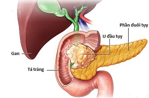 
Tuyến tụy vừa có chức năng ngoại tiết vừa có chức năng nội tiết
