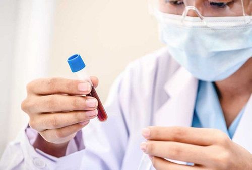 Xét nghiệm HBV - DNA kết quả 210 copies/ml có nguy hiểm không?