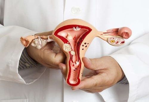 Fallopian tube stasis: Causes, symptoms and treatment