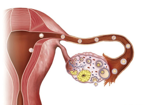 Digital image erasing background and ovarian varicose node