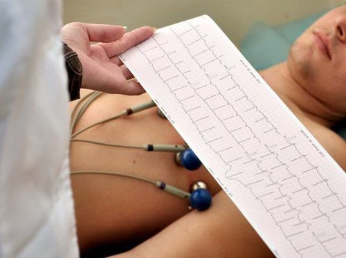 
Bác sĩ có thể chẩn đoán nhịp nhanh thất dựa trên điện tâm đồ ECG
