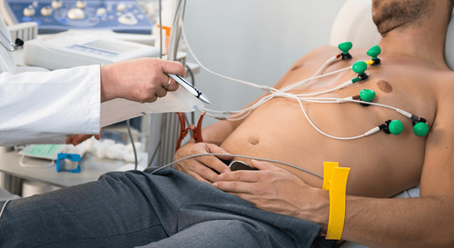 
Phương pháp điện tâm đồ ECG có thể được sử dụng để chẩn đoán đau ngực và nôn mửa
