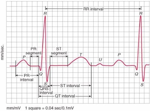 
Vị trí đoạn ST trên kết quả điện tâm đồ
