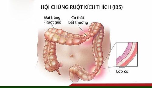 
Hội chứng kích thích ruột có thể được khuyên không nên ăn ngũ cốc
