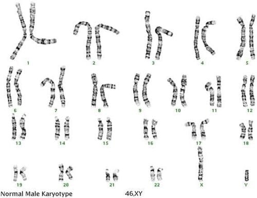 
Karyotype bình thường ở nam giới (Genetic Testing Techniques, 2018)
