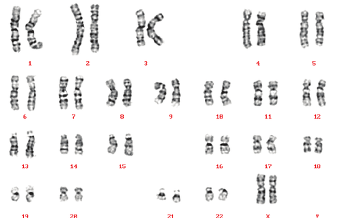 
Karyotype bình thường ở nữ giới (Reproduced courtesy of Human Genome Centre, Universiti Sains Malaysia, Malaysia)
