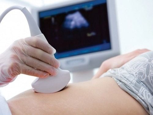 Nhau thai bám thấp ở tuần 23 thai kỳ có nguy hiểm không?