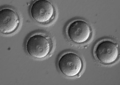 What does embryo quality mean when doing IVF?