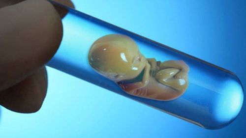 Hỏi đáp: Cách tính tuổi thai IVF chính xác