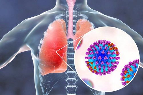 Common types of pneumonia