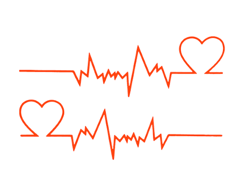 Heart rate above 100 with light exercise is tachycardia?