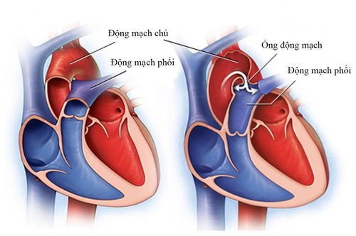 Why do I have a headache while taking medicine to treat the disease?